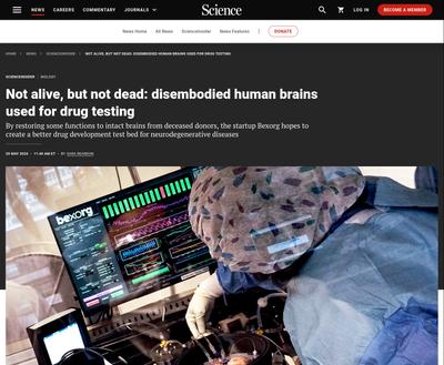 Not alive, but not dead: disembodied human brains used for drug testing | Science | AAAS