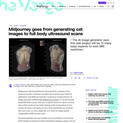 Midjourney Medical goes from AI image generation to full-body ultrasounds | The Verge